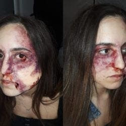 Battered-Woman-COllage-1