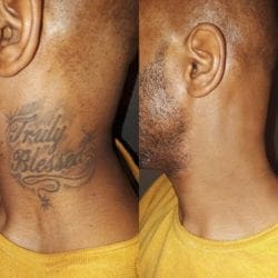 Tattoo-cover-up-1